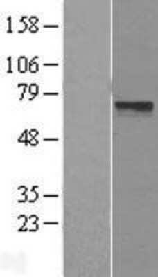 Western Blot: LRRTM3 Overexpression Lysate [NBL1-12715]