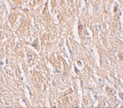 Immunohistochemistry-Paraffin: LRRTM4 Antibody - BSA Free [NBP1-76530]