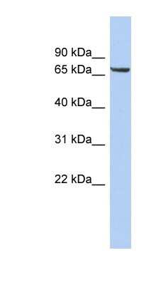 Western Blot: LRRTM4 Antibody [NBP1-62611]