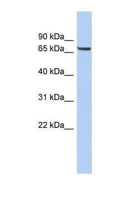 Western Blot: LRRTM4 Antibody [NBP1-69616]