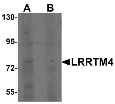 Western Blot: LRRTM4 AntibodyBSA Free [NBP1-76530]