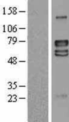 Western Blot: LRRTM4 Overexpression Lysate [NBL1-12716]