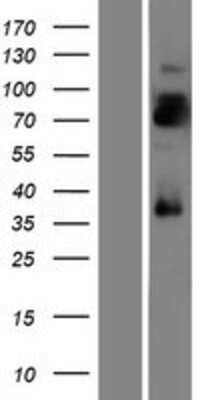 Western Blot: LRRTM4 Overexpression Lysate [NBP2-09554]