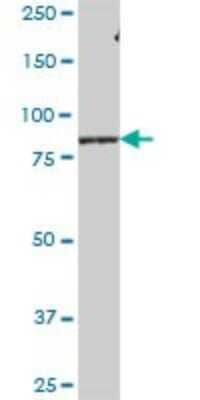 Western Blot: LRSAM1 Antibody [H00090678-B01P]