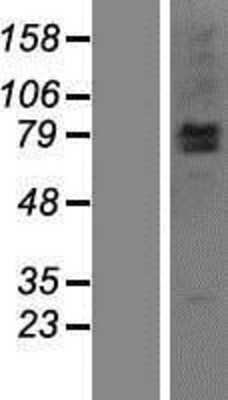 Western Blot: LRSAM1 Overexpression Lysate [NBP2-05663]