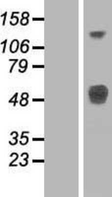 Western Blot: LRTM1 Overexpression Lysate [NBP2-06606]