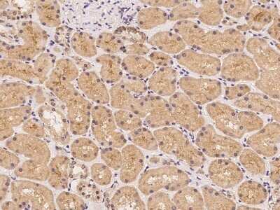 Immunohistochemistry: LRTM2 Antibody [NBP3-06292]