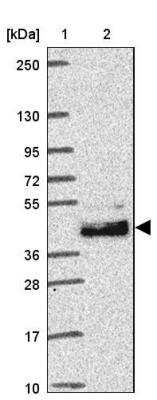 Western Blot: LRTM2 Antibody [NBP2-30649]