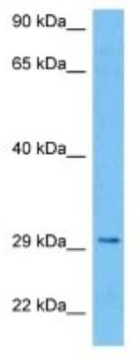 Western Blot: LRTOMT Antibody [NBP3-10049]