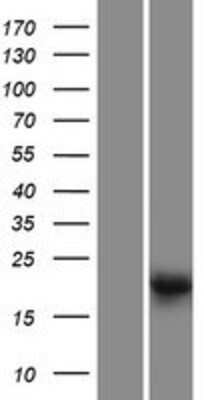 Western Blot: LRTOMT Overexpression Lysate [NBP2-05486]