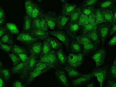 Immunocytochemistry/ Immunofluorescence: LRWD1 Antibody [NBP2-97339]