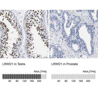 Immunohistochemistry-Paraffin: LRWD1 Antibody [NBP1-85113]