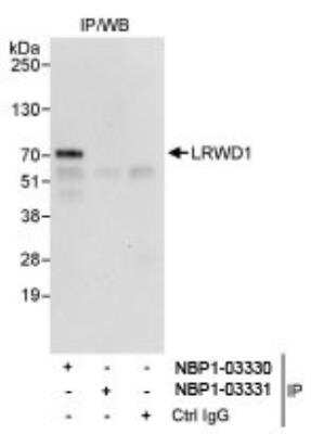 Immunoprecipitation: LRWD1 Antibody [NBP1-03330]