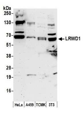 Western Blot: LRWD1 Antibody [NBP1-03331]