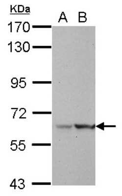 Western Blot: LRWD1 Antibody [NBP2-17176]