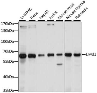 Western Blot: LRWD1 AntibodyAzide and BSA Free [NBP3-03939]