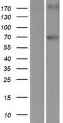 Western Blot: LRWD1 Overexpression Lysate [NBP2-05302]