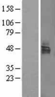 Western Blot: LAMP Overexpression Lysate [NBL1-12718]