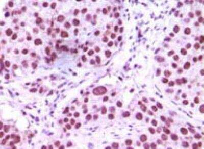 Immunohistochemistry-Paraffin: LSD1 Antibody (1B2E5) [NB100-1762]