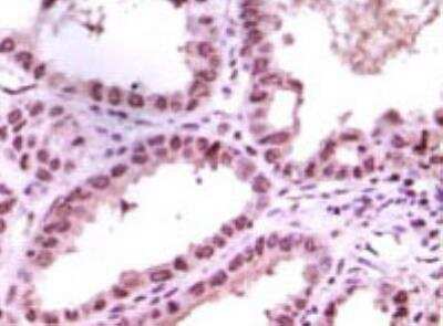 Immunohistochemistry-Paraffin: LSD1 Antibody (1B2E5) [NB100-1762]