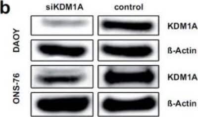 Knockdown Validated: LSD1 Antibody (1B2E5) [NB100-1762]