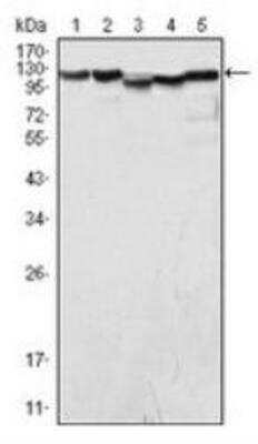 Western Blot: LSD1 Antibody (1B2E5) [NB100-1762]