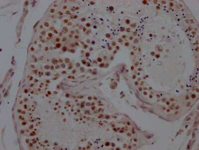 Immunohistochemistry: LSD1 Antibody (1G7) [NBP3-15193]