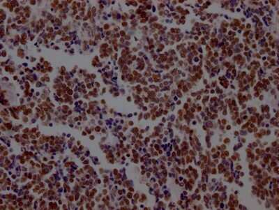 Immunohistochemistry: LSD1 Antibody (1G7) [NBP3-15193]