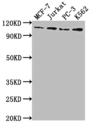 Western Blot: LSD1 Antibody (1G7) [NBP3-15193]