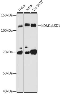 Western Blot: LSD1 Antibody (7R10X6) [NBP3-16688]