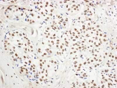 Immunohistochemistry-Paraffin: LSD1 Antibody [NB100-536]