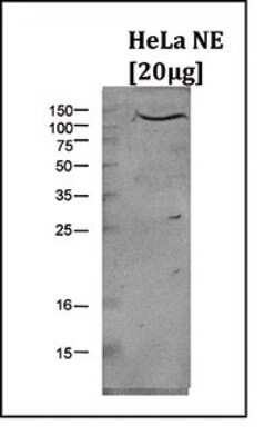 Western Blot: LSD1 Antibody [NBP3-18670]