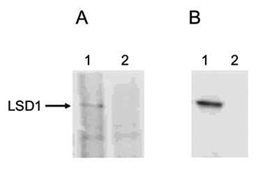 Western Blot: LSD1 Antibody [NBP3-18687]