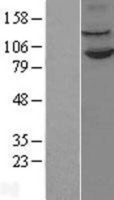 Western Blot: LSD1 Overexpression Lysate [NBL1-07573]