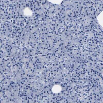 Immunohistochemistry-Paraffin: LSECtin/CLEC4G Antibody [NBP1-82815]