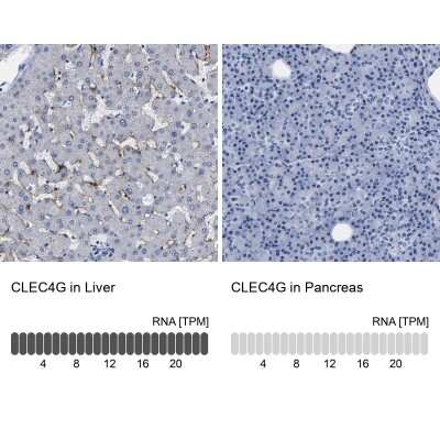 Immunohistochemistry-Paraffin: LSECtin/CLEC4G Antibody [NBP1-82815]