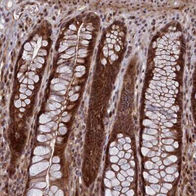Immunohistochemistry: LSG1 Antibody [NBP2-32698]
