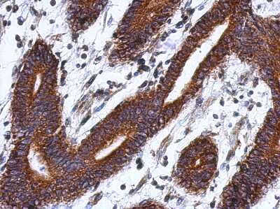 Immunohistochemistry-Paraffin: LSG1 Antibody [NBP2-17178]