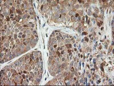 Immunohistochemistry-Paraffin: LSM1 Antibody (OTI5C6) [NBP2-00918]