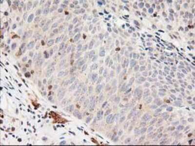 Immunohistochemistry-Paraffin: LSM1 Antibody (OTI5C6) [NBP2-00918]