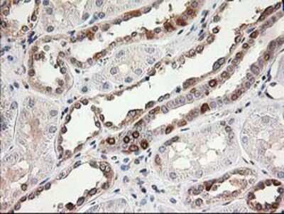 Immunohistochemistry-Paraffin: LSM1 Antibody (OTI5C6) [NBP2-00918]