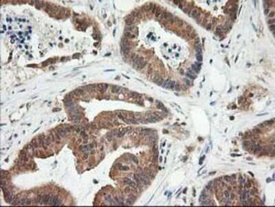 Immunohistochemistry: LSM1 Antibody (OTI5C6) - Azide and BSA Free [NBP2-72547]