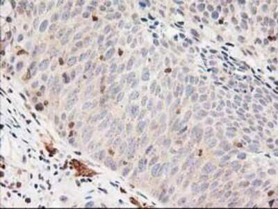 Immunohistochemistry: LSM1 Antibody (OTI5C6) - Azide and BSA Free [NBP2-72547]