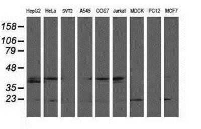 Western Blot: LSM1 Antibody (OTI5C6)Azide and BSA Free [NBP2-72547]