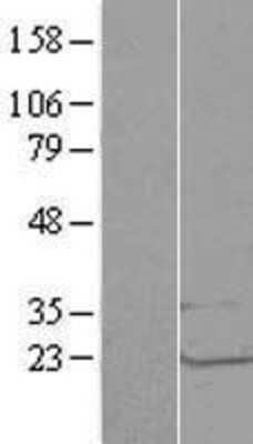 Western Blot: LSM1 Overexpression Lysate [NBL1-12720]