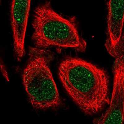 Immunocytochemistry/ Immunofluorescence: LSM10 Antibody [NBP2-14204]