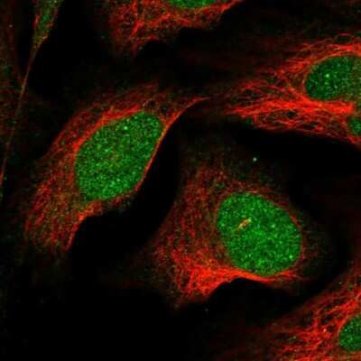 Immunocytochemistry/ Immunofluorescence: LSM11 Antibody [NBP1-81938]