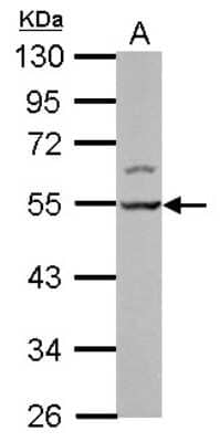 Western Blot: LSM11 Antibody [NBP2-17179]