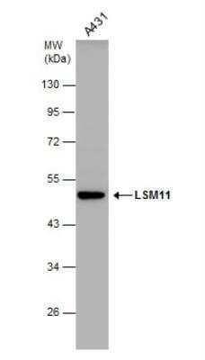 Western Blot: LSM11 Antibody [NBP2-17180]