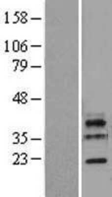 Western Blot: LSM11 Overexpression Lysate [NBL1-12722]